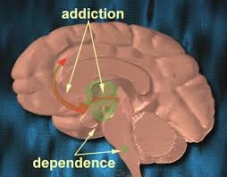 addiction brain