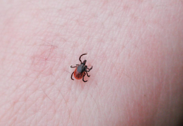 Tick-Borne Illnesses