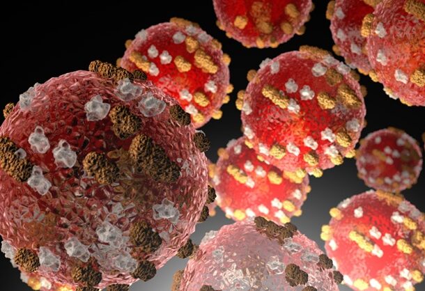 Measles
